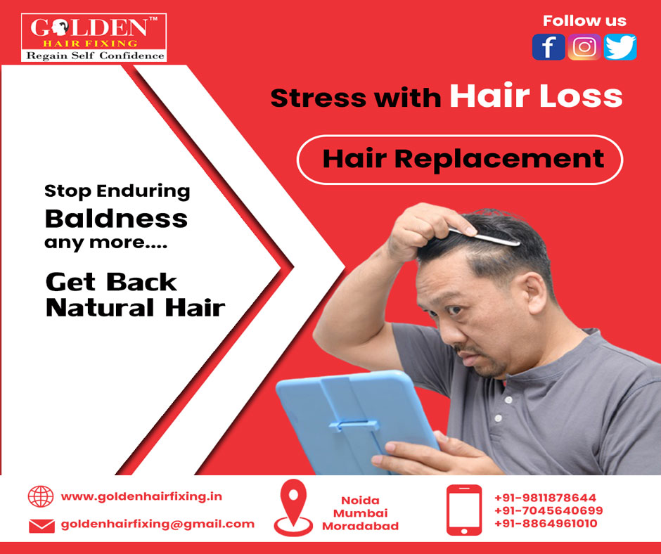 Golden Hair Fixing  Stop Hair Loss with NonSurgical Hair Replacement by Golden  Hair Fixing Clinic experts Clinically proven Great customer reviews 100  natural Services Hair Regrowth 100 Natural   