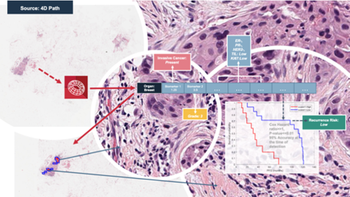 4DPath's tweet photo. .@mobihealthtimes covers our @UniversityLeeds contract extension. We’re grateful to work in an academic clinical setting to demonstrate our strength delivering various #diagnostic outcomes for #breastcancer, & to enable essential molecular #tumorprofiling-https://t.co/SHrGIeM4LZ. https://t.co/luy1z3mtSe