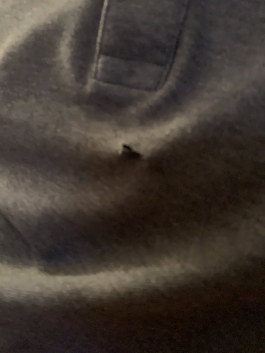 Lexi41423012's tweet photo. I had a fight my dad’s jumper. Lexi 1 - Dad’s jumper 0 https://t.co/xy0BTV4dYS