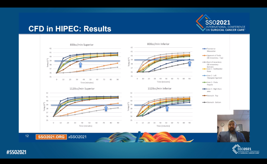 Tyler Mouw (@willchart4food) on Twitter photo Seemed like a positive response at #SSO2021 to our work on using computer sim to optimize HIPEC. <a href="/hipecsurgeon/">HIPECSURGEON</a> we may need to start up that collab we've talked about. Have some ideas for next phase! <a href="/SPeritoneum/">SoMe4Peritoneum</a> <a href="/SocSurgOnc/">Society of Surgical Oncology</a> Seemed like a positive response at #SSO2021 to our work on using computer sim to optimize HIPEC. <a href="/hipecsurgeon/">HIPECSURGEON</a> we may need to start up that collab we've talked about. Have some ideas for next phase! <a href="/SPeritoneum/">SoMe4Peritoneum</a> <a href="/SocSurgOnc/">Society of Surgical Oncology</a>