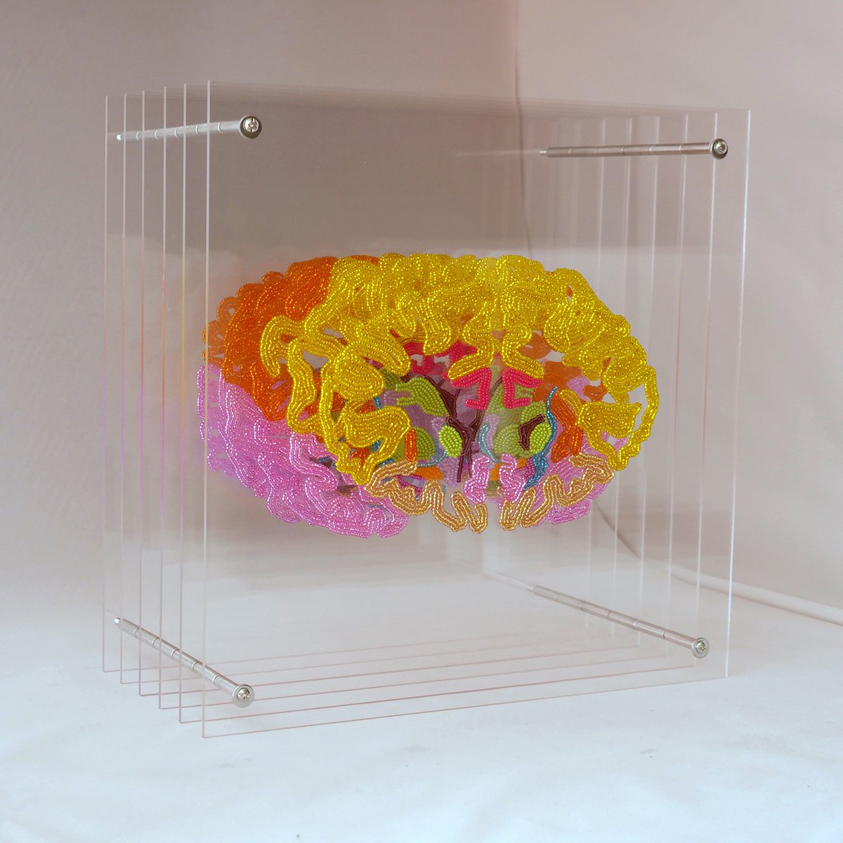 Friedman Brain Institute (@sinaibrain) on Twitter photo CHECK OUT <a href="/MountSinaiAlum/">Mount Sinai Alumni</a> <a href="/YZorina/">Yana Zorina - a.k.a. NeuroBead</a>'s BRILLIANT MIND. This unique #SciART is based on 6 coronal sections of the #humanbrain from the <a href="/AllenInstitute/">Allen Institute</a>'s Brain Atlas. Each brain structure is represented in a different color. VOTE NOW #ArtoftheBrain image #13. Mostā„ļø's wins! #BAW2021 CHECK OUT <a href="/MountSinaiAlum/">Mount Sinai Alumni</a> <a href="/YZorina/">Yana Zorina - a.k.a. NeuroBead</a>'s BRILLIANT MIND. This unique #SciART is based on 6 coronal sections of the #humanbrain from the <a href="/AllenInstitute/">Allen Institute</a>'s Brain Atlas. Each brain structure is represented in a different color. VOTE NOW #ArtoftheBrain image #13. Mostā„ļø's wins! #BAW2021