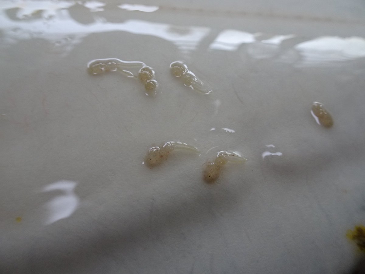 こっ子 裏面 生物アカ カレイの体表に付いた寄生虫 どなたかお詳しい方 この子達の名前を教えて頂けないでしょうか ググッた感じだとカイアシ類のカリグスさんでしょうか 寄生虫 体表寄生虫 教えて 魚