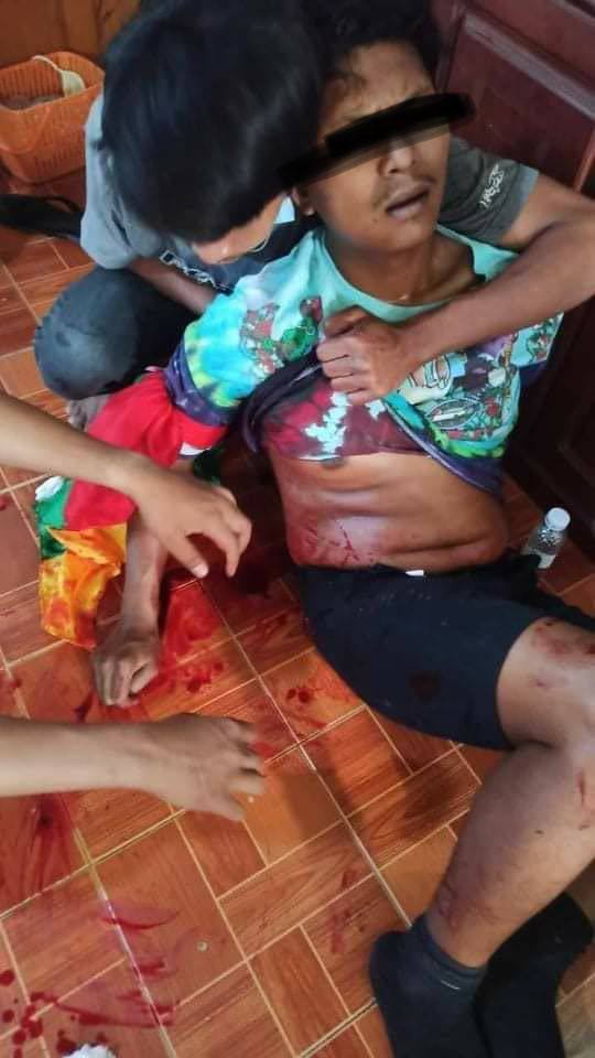 aprilmha's tweet photo. tw // blood
In #Paung, Mon State, two men got shot by military junta terrorists around 12:30am yesterday while they’re biking. One died on the spot and the dead body is taken by junta terrorists.
SUPPORT FEDERAL DEMOCRACY
#Mar20Coup 
#WhatsHappeningInMyanmar https://t.co/NU5hzzc0Jk
