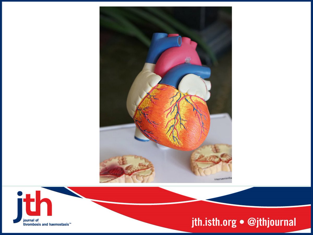 JTH (@jthjournal) on Twitter photo New article: Non‐surgical #bleeding is major complication after left ventricular assist device (LVADs) implantation. Klaeske et al <a href="/leipzig_heart/">Leipzig Heart Institute</a> find surface expression level of P‐selectin & GPIbα on #platelets 📉 in bleeders & more ROS. bit.ly/3eYMBX2 #openaccess New article: Non‐surgical #bleeding is major complication after left ventricular assist device (LVADs) implantation. Klaeske et al <a href="/leipzig_heart/">Leipzig Heart Institute</a> find surface expression level of P‐selectin & GPIbα on #platelets 📉 in bleeders & more ROS. bit.ly/3eYMBX2 #openaccess