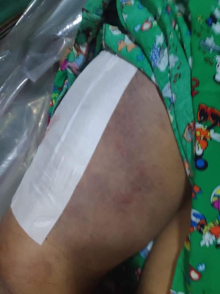 SoeHoneyCho's tweet photo. A mother of 3 kids was shot and detained by Military Junta during a crackdown on night protests in Pakokku Tsp, Magwe Region on Friday. The family of Daw Mar Lar Win, 39, was told by military to retrieve her body on Saturday morning. 
#WhatsHappeningInMyanmar https://t.co/E4sgbF5ohR
