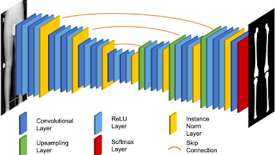 Radiology_AI's tweet photo. Fast, accurate #DeepLearning method to measure bone length and assess lower extremity alignment https://t.co/JJZBRFk1EW @UniklinikDUS @UniklinikAachen @RWTH #MSKrad #LegLength #RadAI https://t.co/o1bF2lDEkH