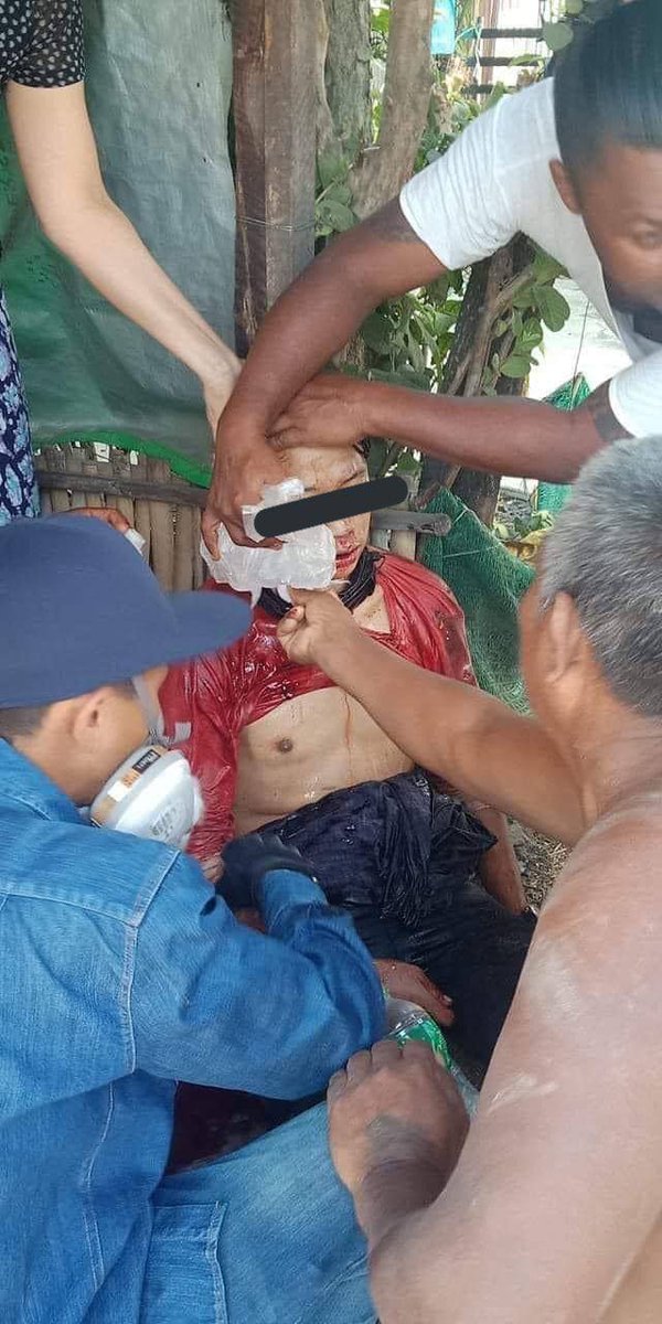 MMTumcial's tweet photo. Tw // blood
Three people were shot with real bullets by junta terrorists in TharKayTa. All of them were severely wounded and one was reportedly dead in Thaketa 6th ward.
SUPPORT FEDERAL DEMOCRACY
#WhatsHappeningInMyanmar  #Mar20Coup https://t.co/iUJ7CUeeFK