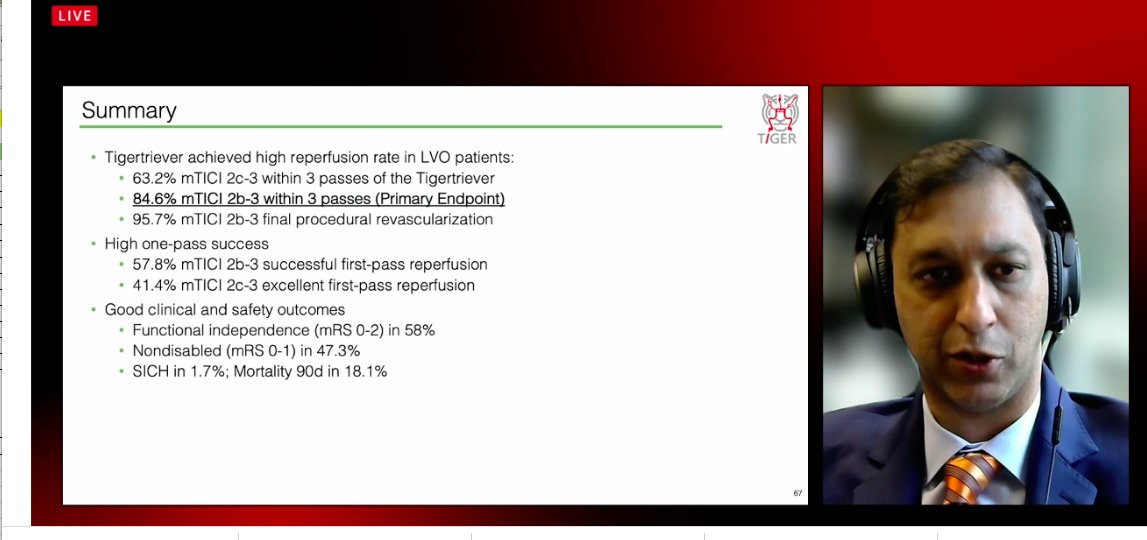 NguyenThanhMD's tweet photo. Radially Adjustable Stentrievers for Acute #Stroke: Results of the Tiger Trial. #ISC21 Congrats Rishi Gupta, @AshuPJadhav @EladLevyMD @oozaidat @dyavagal @SandraNarayanan @AmeerEHassan @AjitSPuri1 @STateshimaMD @_AdnanSiddiqui  https://t.co/wlGODwLjnv https://t.co/mFVACaEMuf