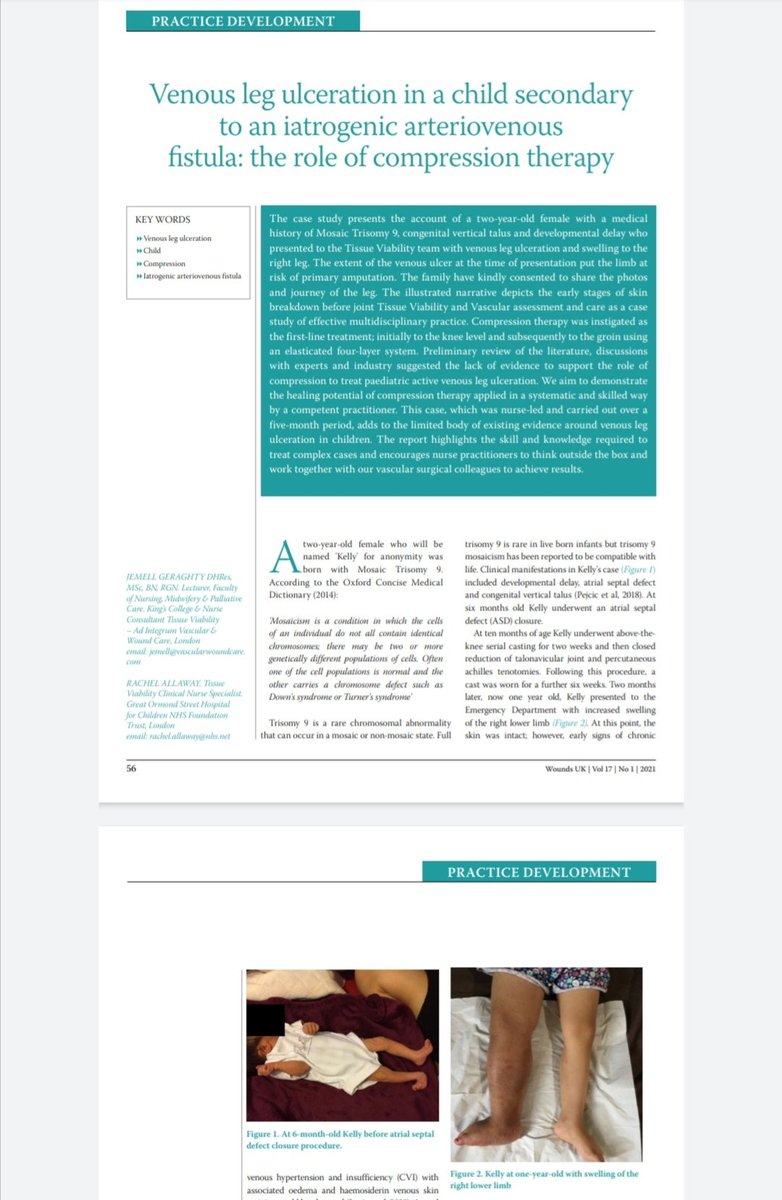 Dr Jemell Geraghty (@woundnurseuk) on Twitter photo Leg ulceration normally occurs in adults. Read my latest paper about venous leg ulceration in a 2year old child👶🦵🍼 together with Rachel Allaway <a href="/goshtvn/">TVNteam@gosh</a> & Vascular Team treated & healed with compression bandaging 👍Full paper <a href="/Wounds_UK/">Wounds UK</a> wounds-uk.com/journals/issue… <a href="/AdIntegrumVas/">Vascular & Wound Care</a> Leg ulceration normally occurs in adults. Read my latest paper about venous leg ulceration in a 2year old child👶🦵🍼 together with Rachel Allaway <a href="/goshtvn/">TVNteam@gosh</a> & Vascular Team treated & healed with compression bandaging 👍Full paper <a href="/Wounds_UK/">Wounds UK</a> wounds-uk.com/journals/issue… <a href="/AdIntegrumVas/">Vascular & Wound Care</a>