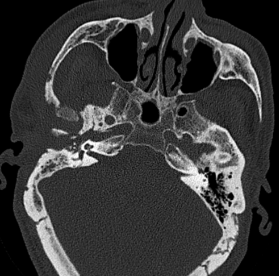 UMaryland Neuroradiology tweet media