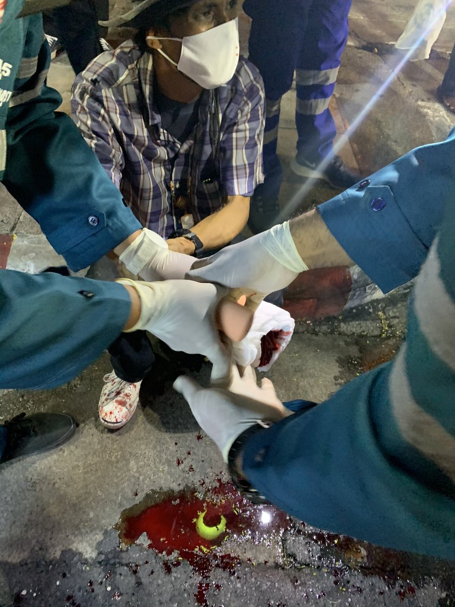 Kumpol_tt's tweet photo. เลือดจริง เจ็บจริง เสียงระเบิดดังปั่ง และพี่คนนี้ก็วิ่งออกมาพร้อมมือโชกเลือด #ม็อบ20มีนา https://t.co/VBV2CrhPkJ