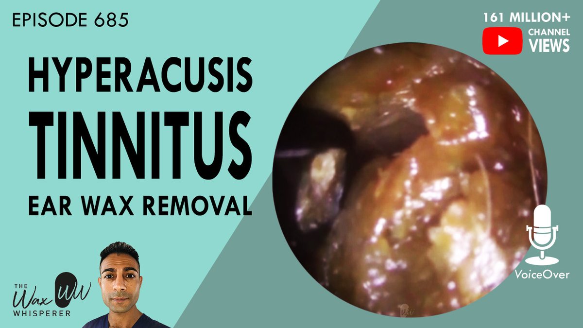 TheHearClinic's tweet photo. 685 - Hyperacusis Tinnitus Ear Wax Removal https://t.co/VeKDakcc2l via @YouTube #tinnitus #hyperacusis #earwaxremoval #earwax #earwaxextractions #earwaxextraction #earwaxblockageremoval #earwaxremoving #earwaxextraction #earwaxmicrosuction #endoscopicmicrosuction #earcleaning https://t.co/RjFyHRrbJZ