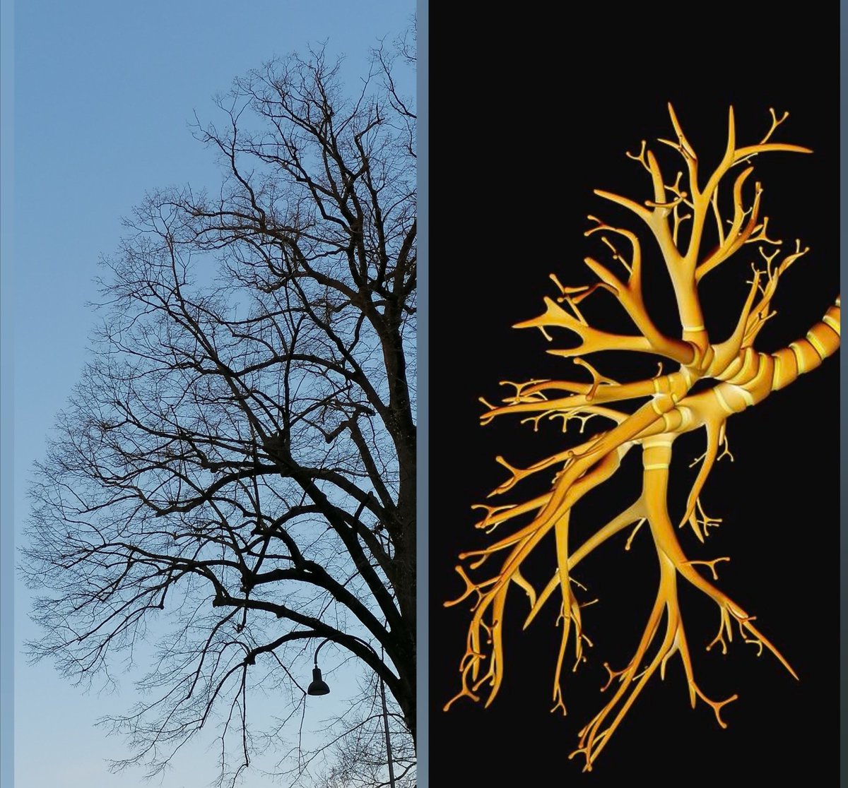 ortens84's tweet photo. I had this late afternoon #pathreidolia, my Master @smlungpathguy
#bronchialtree https://t.co/ANpNWX8Xgg