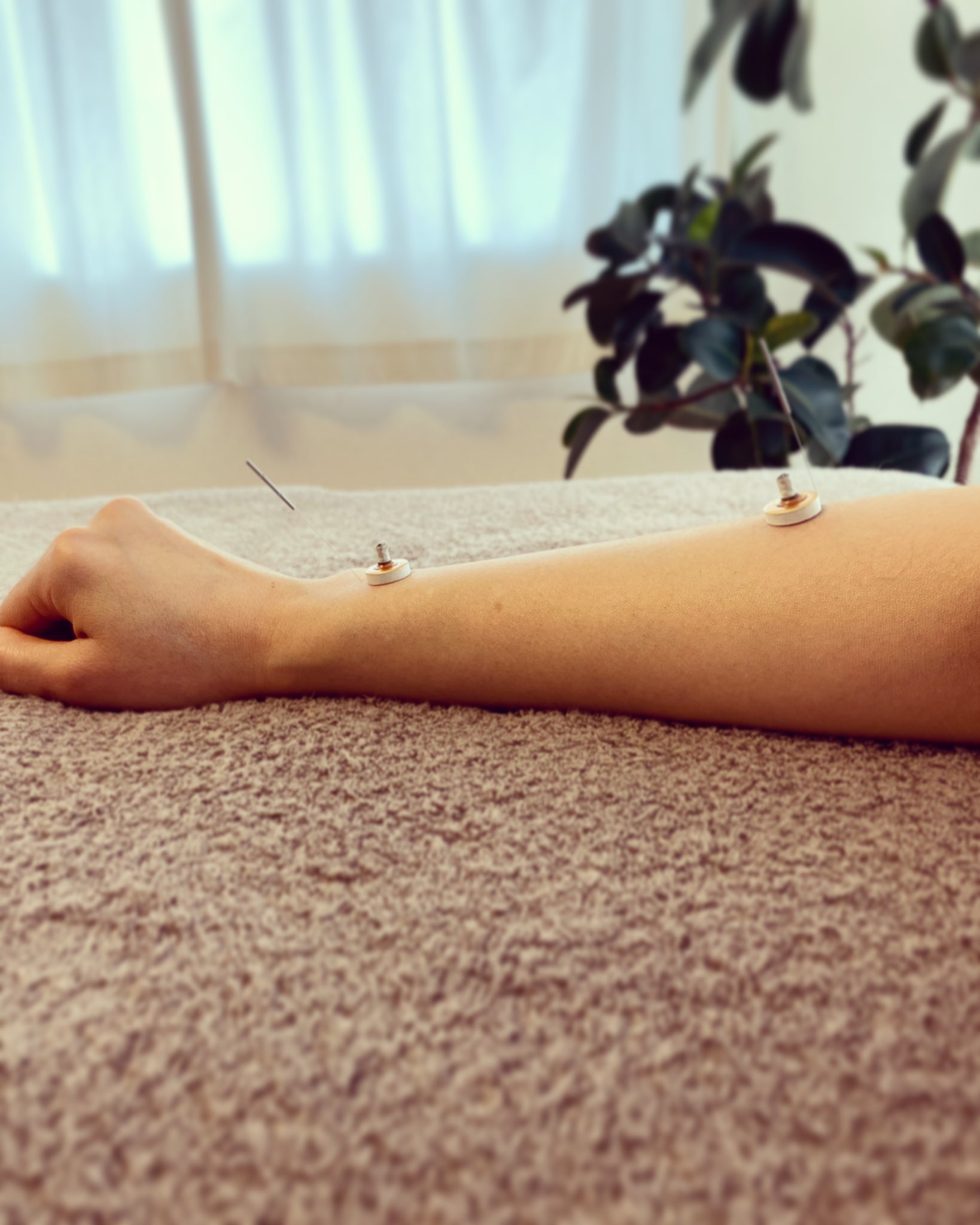 Kubota鍼灸院 Kubota Acupuncture Clinic 手首の背屈痛の治療です スマホの使い過ぎでの痛みも治療できます 鍼灸 代々木上原 代々木八幡 東北沢 手首 背屈 痛み Acupuncture スマホ痛 Yoyogiuehara Yoyogipark Higashikitazawa Wrist
