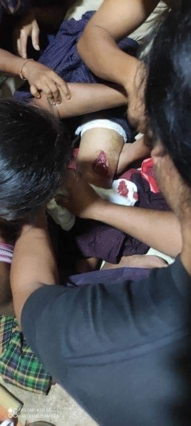HlaingThaYar Shooting; Soldiers shot night strike against military regime, with live rounds n baton rounds.Two man were badly injured last night.

TW// Wound Blood
RELEASE THE ARRESTED
#Mar9Coup
#WhatsHappeningInMyanmar
