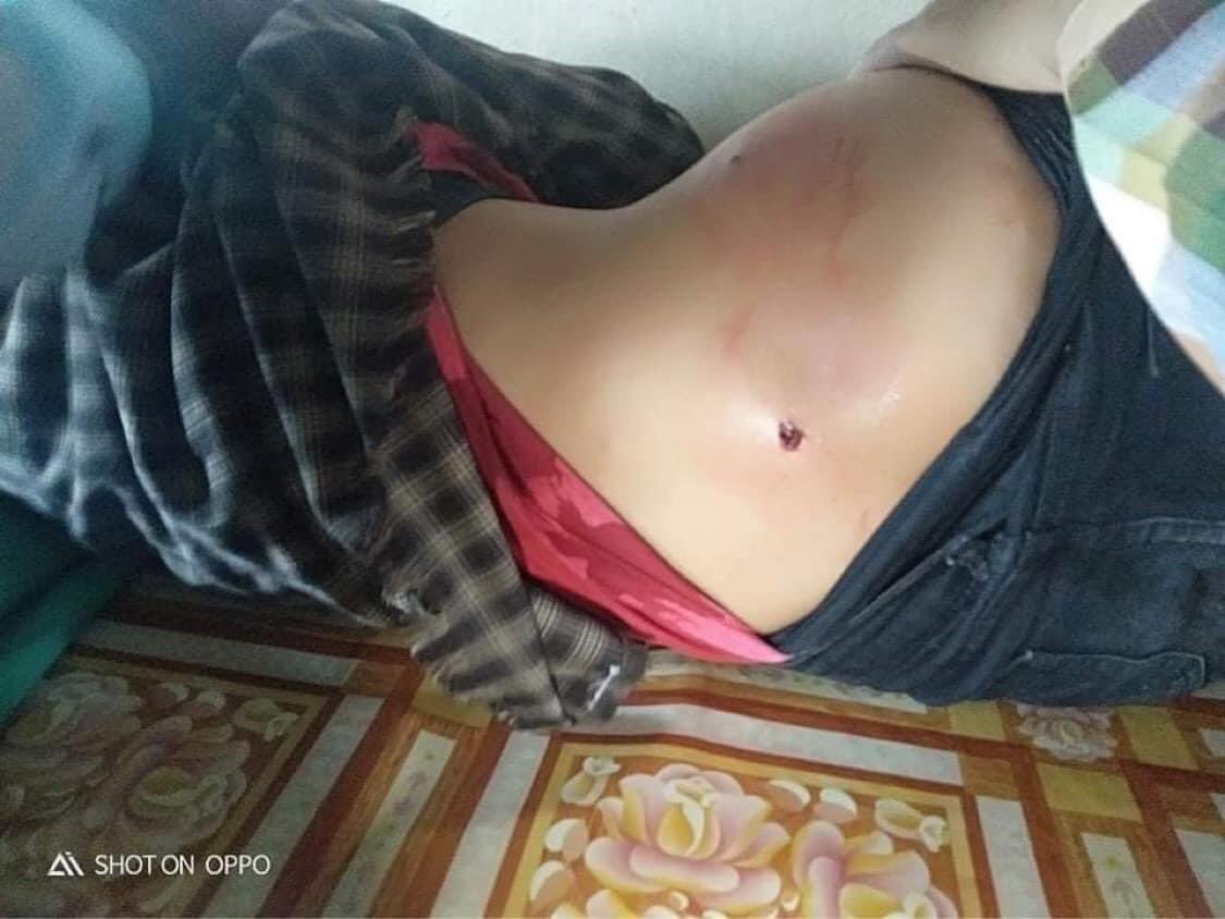 뮨규 (@daldalk) on Twitter photo Tw// Blood ; MoeNyinn; two civilians were seriously injured by Military terrorists. One was shot with real bullets while the other was shot with rubber bullet
RELEASE THE ARRESTED #WhatsHappeningInMyanmar #Mar9Coup #R2PforMyanmar <a href="/Reuters/">Reuters</a> <a href="/UN/">United Nations</a> @camanpour <a href="/UN_HRC/">UN Human Rights Council</a> <a href="/Juarawee/">Juarawee K. (Lina)</a> Tw// Blood ; MoeNyinn; two civilians were seriously injured by Military terrorists. One was shot with real bullets while the other was shot with rubber bullet
RELEASE THE ARRESTED #WhatsHappeningInMyanmar #Mar9Coup #R2PforMyanmar <a href="/Reuters/">Reuters</a> <a href="/UN/">United Nations</a> @camanpour <a href="/UN_HRC/">UN Human Rights Council</a> <a href="/Juarawee/">Juarawee K. (Lina)</a>