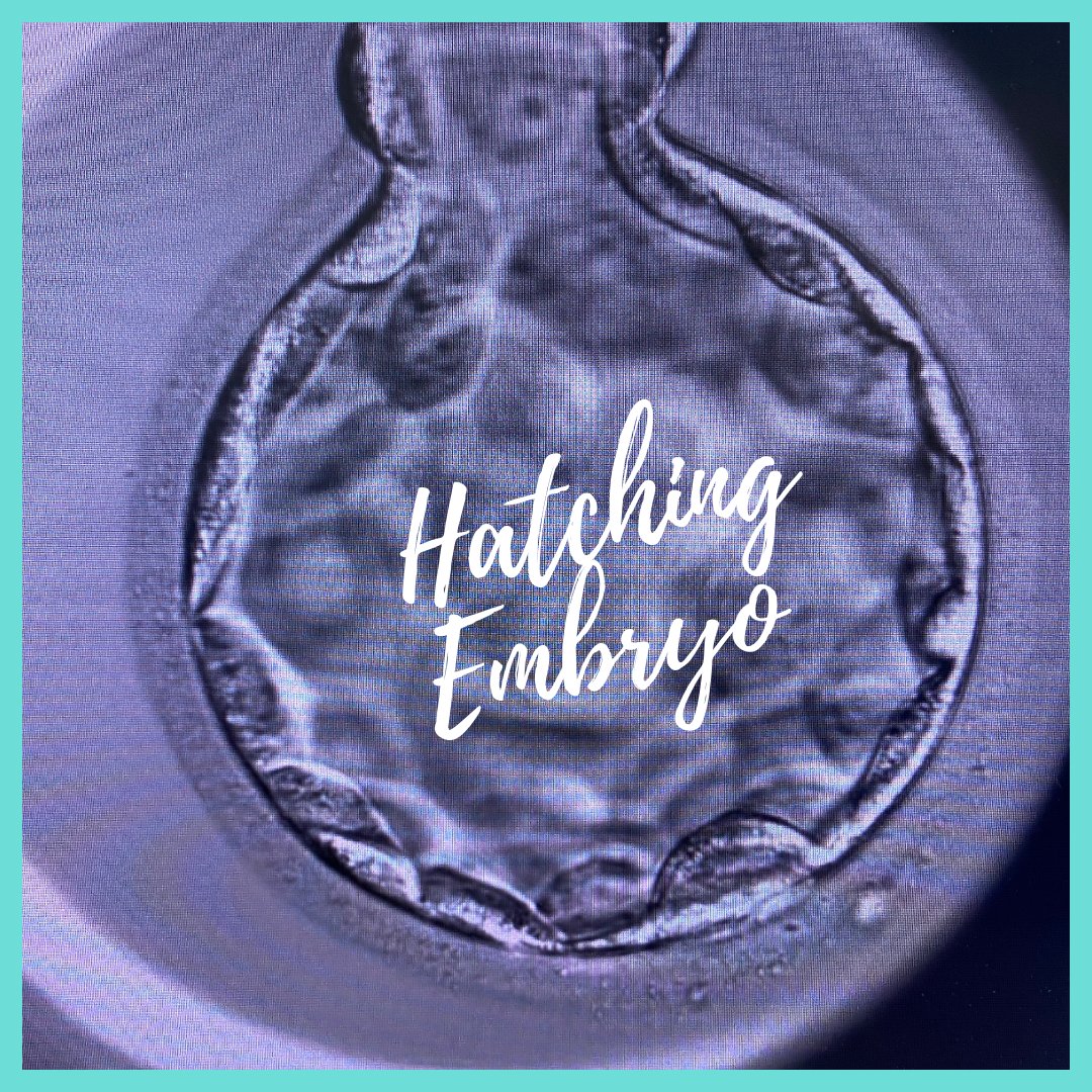 A beautiful hatching embryo ready for biopsy 
#embryo #ivf #fertilitytreatment