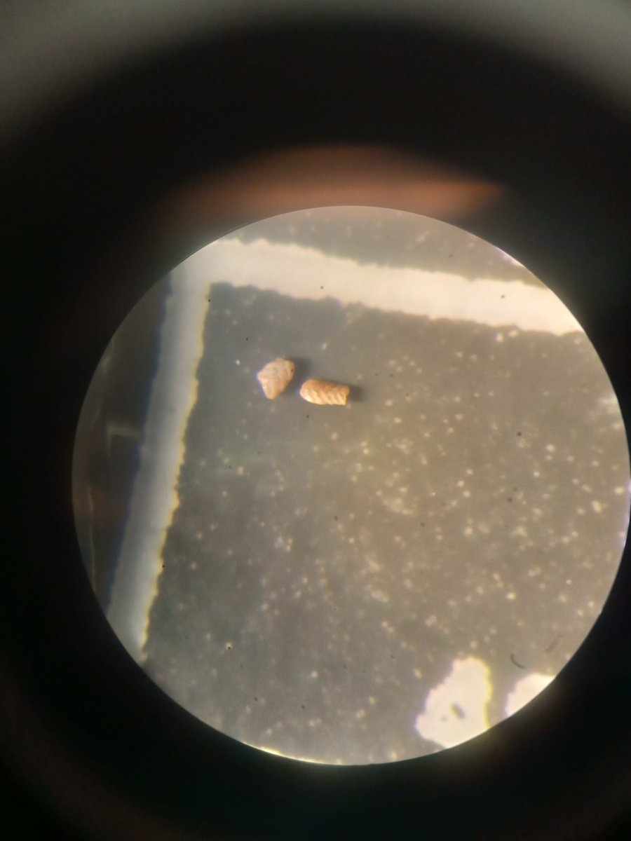 TheDJ_King's tweet photo. Anyone know what the heck these forams are? I'm thinking maybe a Bolivina of some kind? https://t.co/jcljvpsVjZ