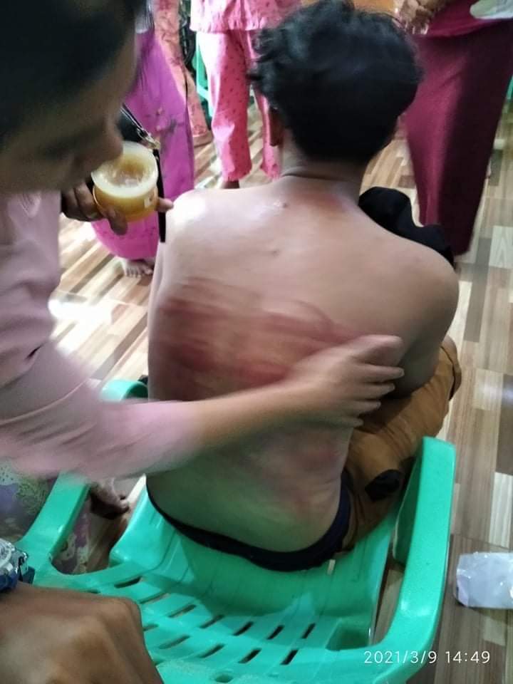 TW : Physical Violence
Today, some young protesters who were arrested by the police in #Myeik are released like that.
RELEASE THE ARRESTED
#WhatsHappeningInMyanmar
#Mar9Coup
