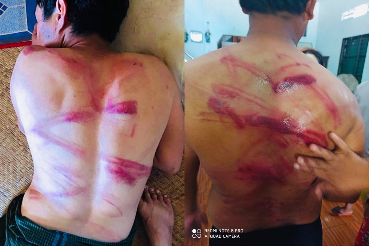 On March 9, in Myeik township this morning, young protesters were detained and beaten with motorcycle chains by the Myanmar Junta's Police.

#Mar9Coup
#WhatsHappeningInMyanmar
#SaveMyanmar
#StopMilitaryCoup
