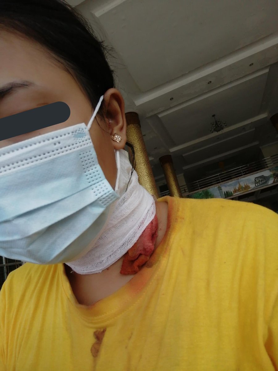 A girl who was hiding frm the terrorists was shot in the neck with rubber bullet in a very close range. They kicked the door open, shot her &amp; arrested everyone in the house. She was sent to hospital but the rest were beaten up brutally.Some were released but some were imprisoned.