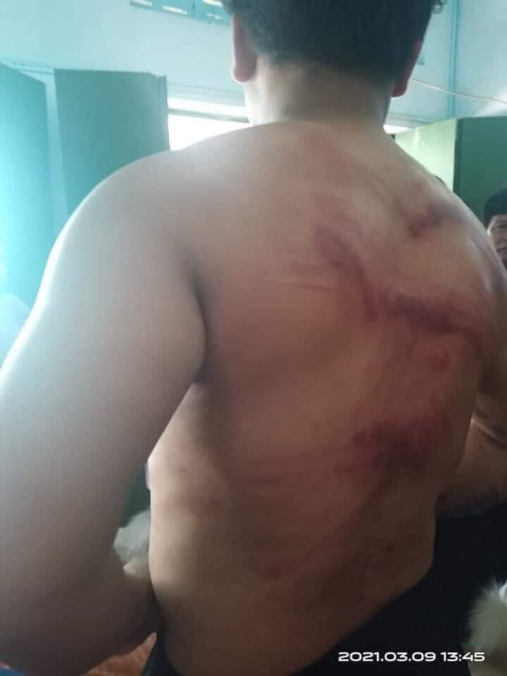 NariPhyo's tweet photo. Torturing protesters to Death; Riot police violently beat detained protesters in custody in Myeik. One protester died due to injuries got in custody last 2days ago in Muse.

RELEASE THE ARRESTED
#Mar9Coup
#WhatsHappeningInMyanmar https://t.co/tuDIisPfcs