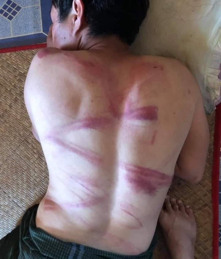 CrphMyanmar's tweet photo. Myanmar
Brutality and #HumanRightViolations by the terrorist military junta. This photo shows how a student who has been arrested by the military was severely beaten. Military doing such kind of brutality and atrocities to those who have been arrested.
#ResponsibilityToProtect https://t.co/OjDVVevORT