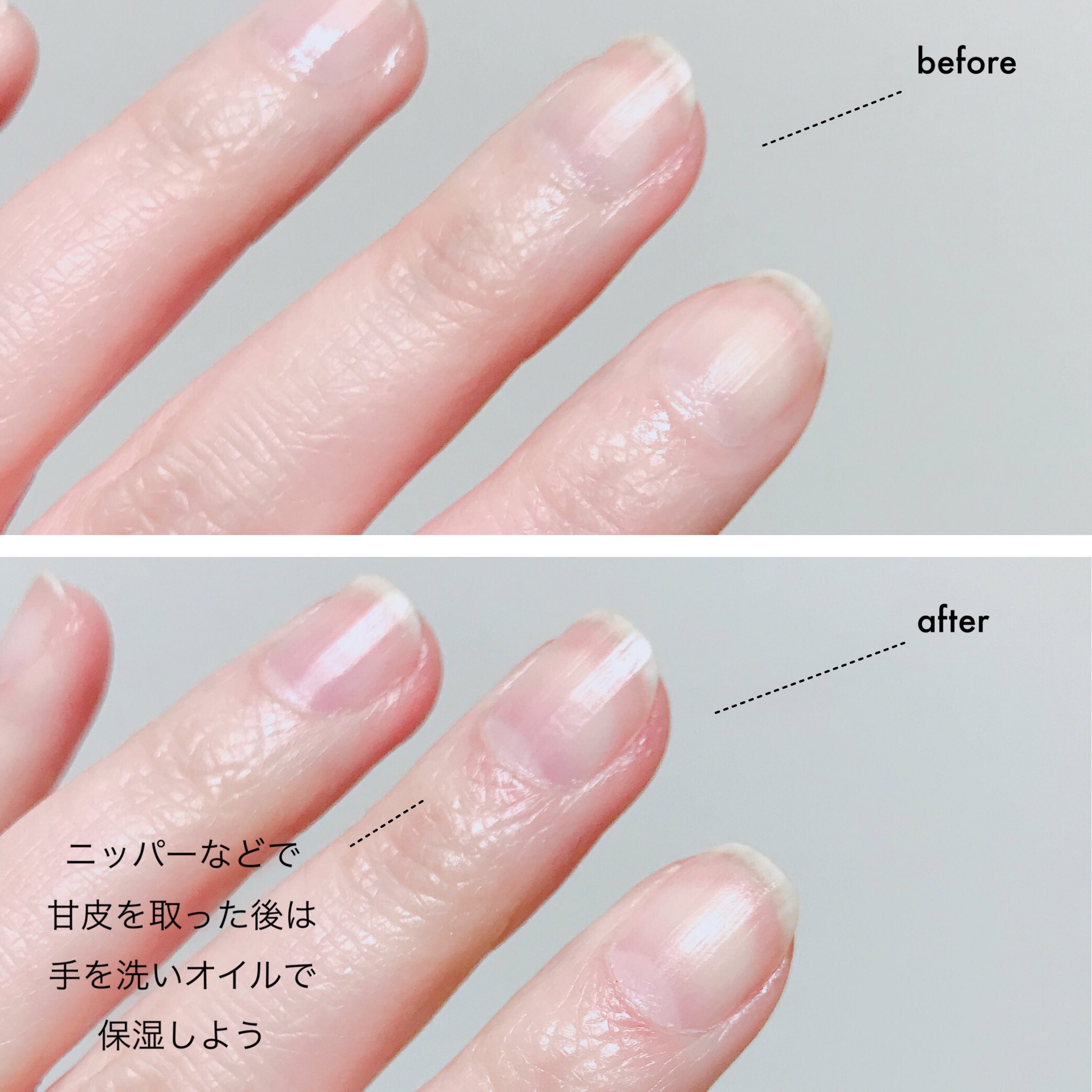 一藤 ブルークロス キューティクルリムーバー これは湯船で甘皮ふやかして取ろうとしてしょっちゅう流血してた私を救う品 甘皮を液でさっとひと撫でしてプッシュするだけで どこに隠れとったんや とわりと引くレベルで甘皮取れる