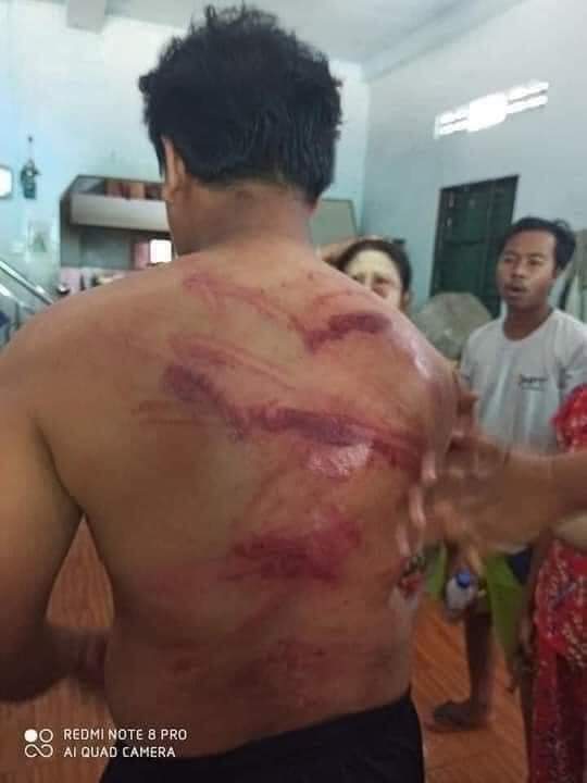 Tonight police arrested innocent civilians and forced them naked and beat them with the use of leather belt, till it bleed.
<a href="/freya_cole/">Freya Cole</a>  <a href="/RapporteurUn/">UN Special Rapporteur Tom Andrews</a> 
#March9Coup 
#WhatsHappeninglnMyanmar 
#HumanRightViolations