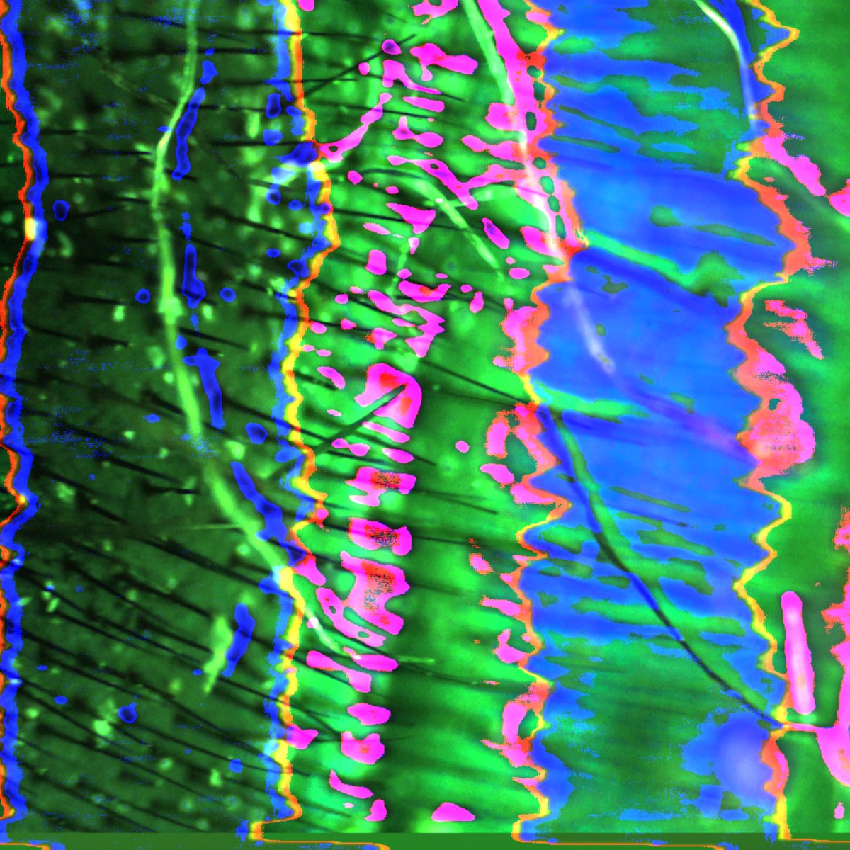 OrchestraRandom's tweet image. Love playing around with the microscope and the #lzxvidiot. „Inhale“ music video coming soon.
.
.
#lzxindustries #videosynth #audiovisual 
#analogvisuals #vidiot #microscope #patterndesign #analogsynth