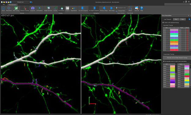 MBFBioscience's tweet photo. We have a new #webinar!
Join us once again as we take a deep dive into our latest software, #MicroDynamix!
In this TJIF you'll learn how to track and analyze #dendriticspine motility in high resolution repeated imaging experiments.
Register here: https://t.co/YyCuD3oV8j https://t.co/hIzt9a1rbq