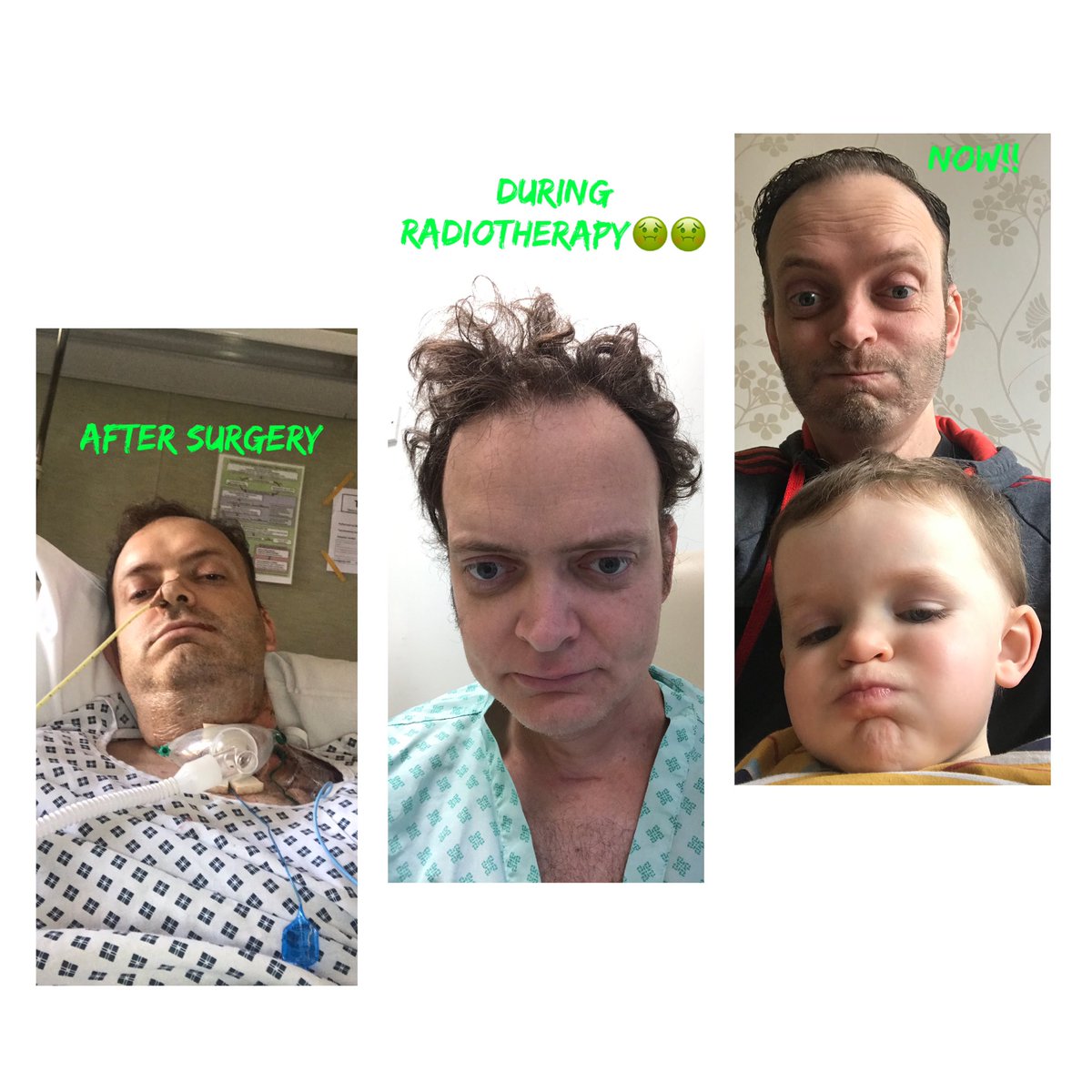 gazz831's tweet photo. My journey in pictures...@macmillancancer #cancer #winningthefight #badhair @ZoeSamp84 https://t.co/jt7wzYV6Jz
