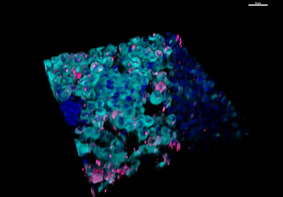PrincetonMolBio's tweet photo. Princeton’s leading cancer researchers, including Yibin Kang, were startled to discover that what they thought was a straightforward investigation into how cancer spreads through the body turned up evidence of liquid-liquid phase separations.
https://t.co/ie5JJAjIAC https://t.co/h0f8YaQQxg