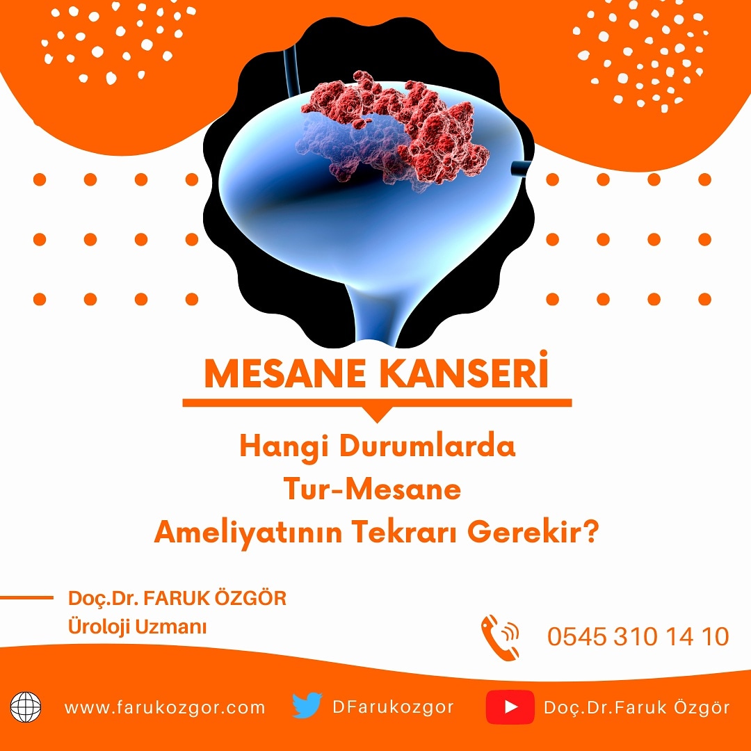 DFarukozgor's tweet photo. Mesane kasına yayılımı olmayan yüksek riskli hastalara tekrar TUR-mesane ameliyatı yapılması önerilir 📌

Çok sayıda ve 3 cm'den büyük tümörü olan, yüksek dereceli tümörü olan ve tümörün mesane kasına yayılımı değerlendirilemeyen hastalar YÜKSEK RİSKLİ olarak kabul edilir❗ https://t.co/GjbHLAro2Y
