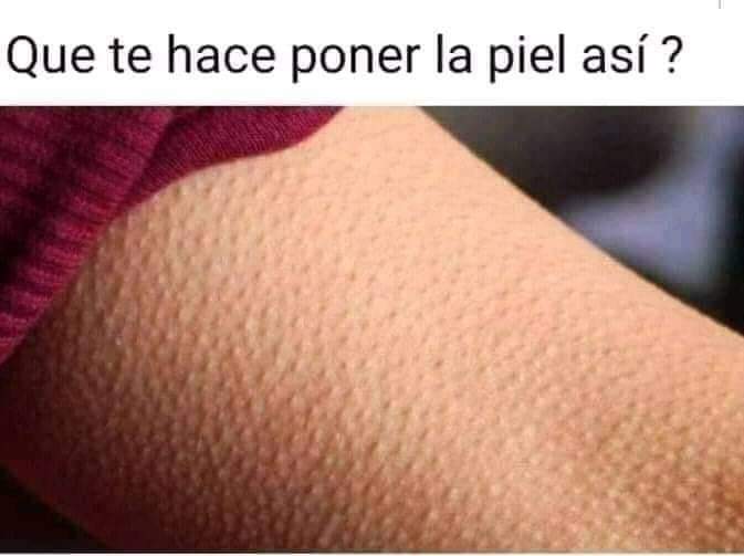 Que les pone la piel así ?? https://t.co/lgEw7Yni9f