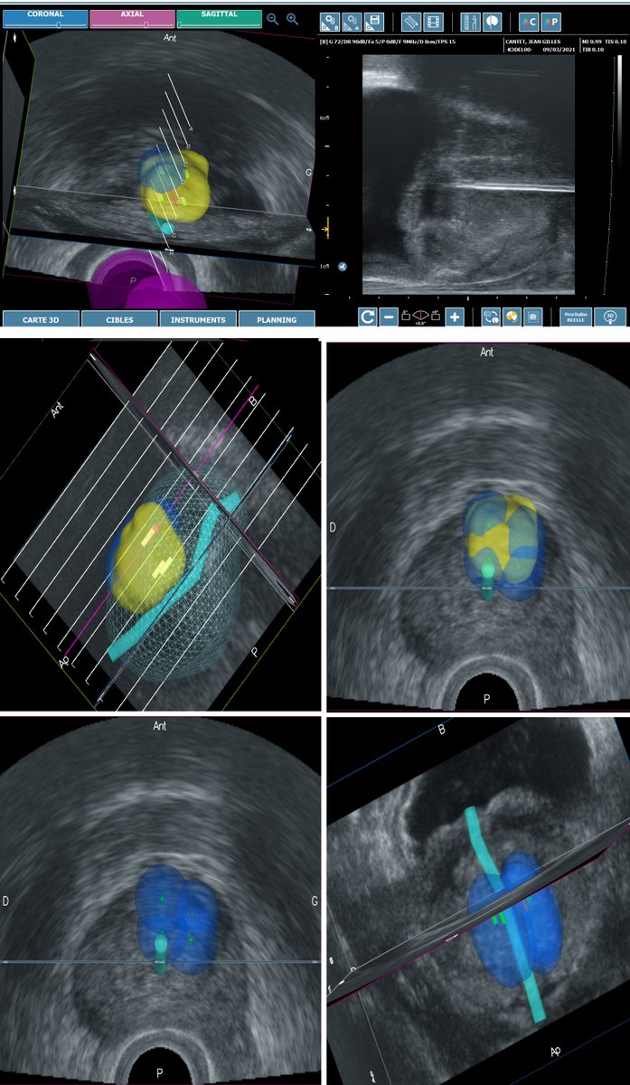 Clinique Urologique Nantes-Atlantis tweet media