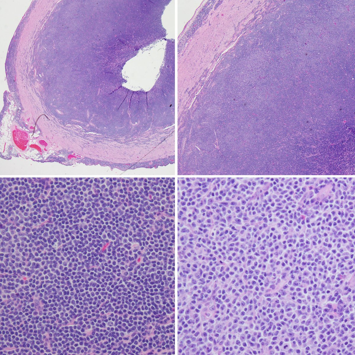 LoyolaHemePath's tweet photo. First years @RegmiAayushma @ElnazPanah @SandoraHaddad @CEKanakisMD! Let's warm up for HemePath club on Thursday. What is the location and diagnosis? https://t.co/kmTszrmksJ