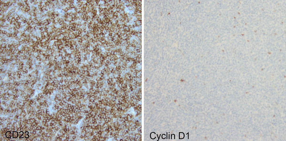 LoyolaHemePath's tweet photo. First years @RegmiAayushma @ElnazPanah @SandoraHaddad @CEKanakisMD! Let's warm up for HemePath club on Thursday. What is the location and diagnosis? https://t.co/kmTszrmksJ