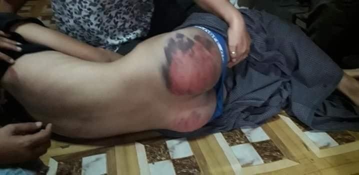 Hlaing1Yu's tweet photo. The boys arrested in Myeik were stripped naked in the Myeik Air Force and asked if they would still be called war dogs & Another asked me to sing the song "Thwe Thit Sa" He also slapped her cheek, saying it was bad. #Mar10Coup #BeatToDeath #WhatsHappeningInMyanmar #Myeik https://t.co/2rbNMUAeKL