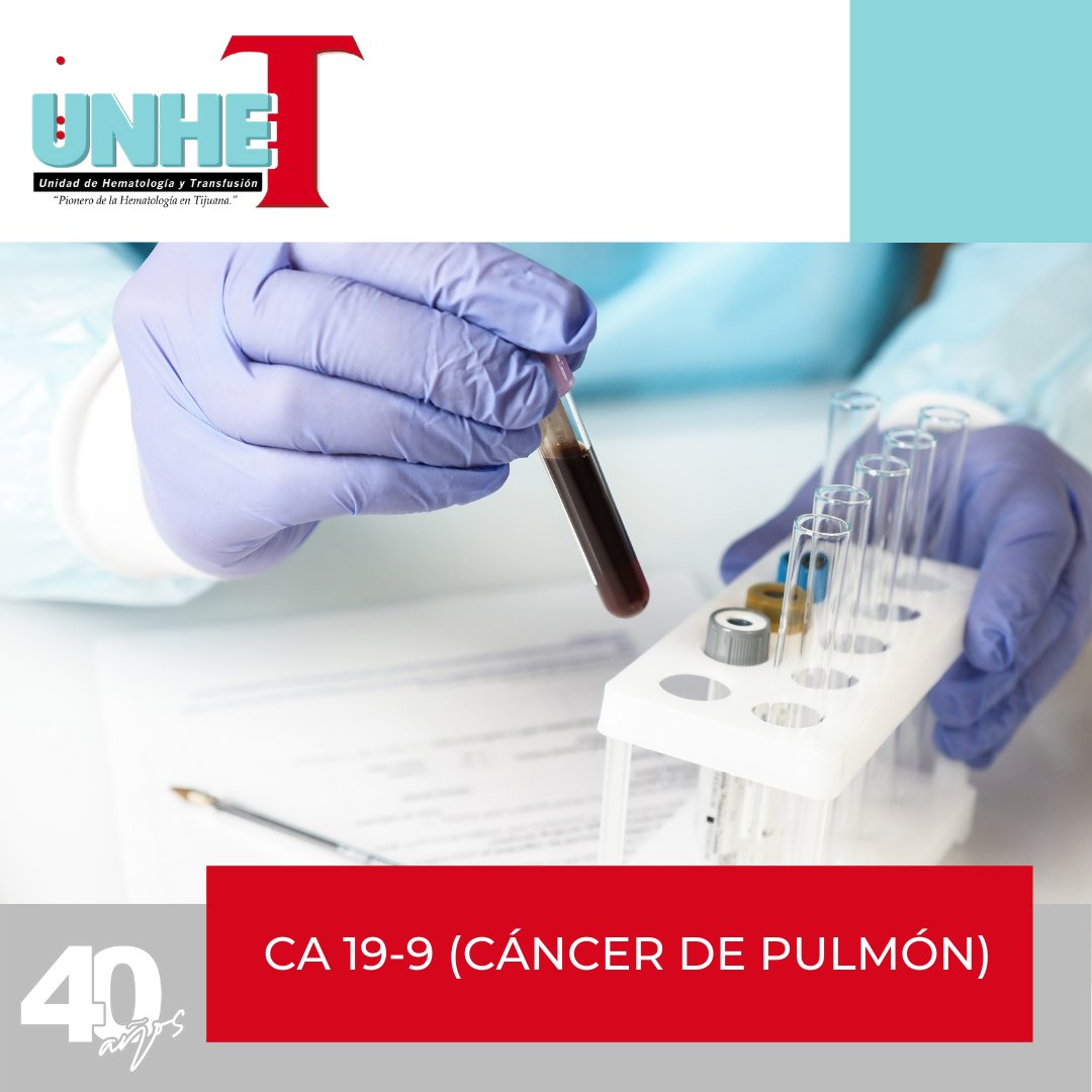 UneteLab's tweet image. Realizamos estudios especiales como Marcadores de cáncer (CA 19-9 para cáncer de pulmón)

Pregunta por las indicaciones previas y has tu cita a los telefonos:
TIJUANA: Laboratorio: 📞664 103 6131
ROSARITO: Laboratorio: 📞661 124 1869

#AnalisisClinicos #Salud #cancerdepulmon