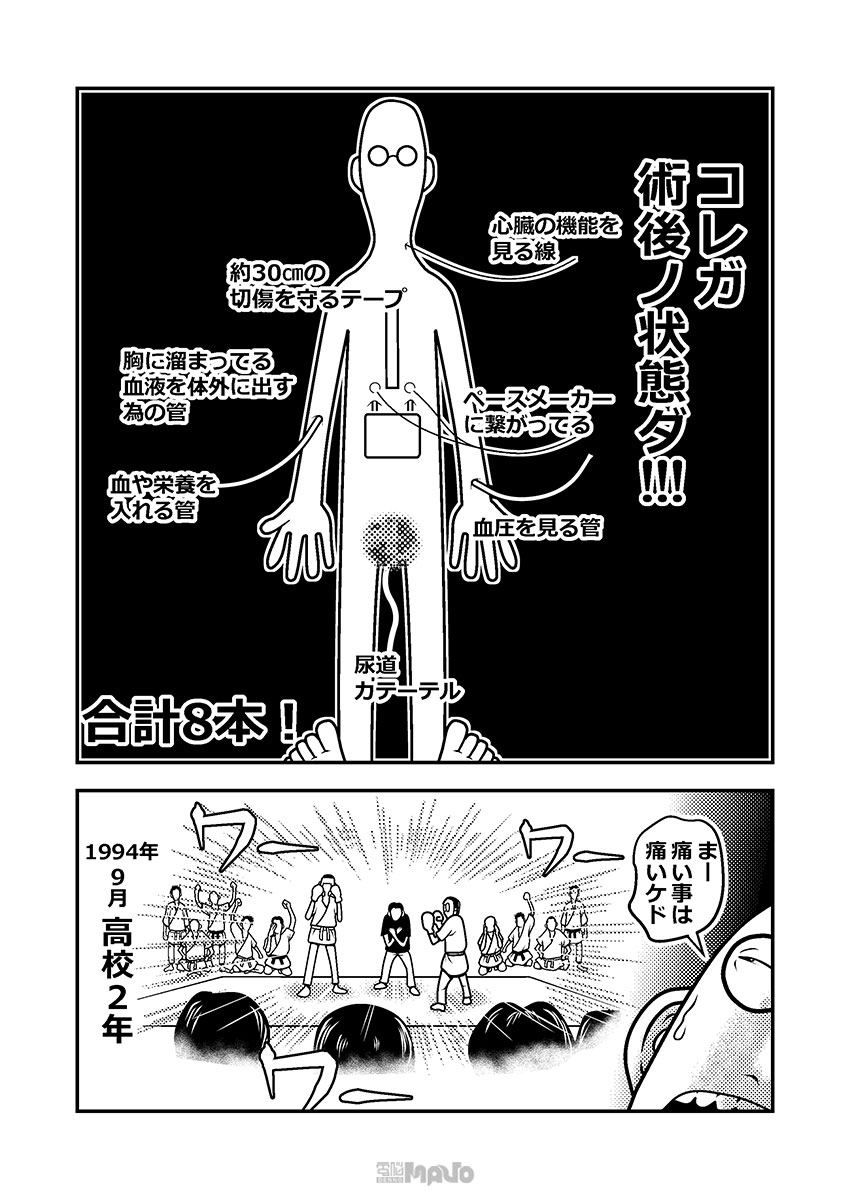 Denno_MAVO's tweet photo. #電脳マヴォ シメノ シロー「ハツ手術 19~21話」を更新しました。微妙にしか進んでないけど、誠実に回復してくれてんだ…
https://t.co/iQjbvpFiZv https://t.co/5FeYeTrekD