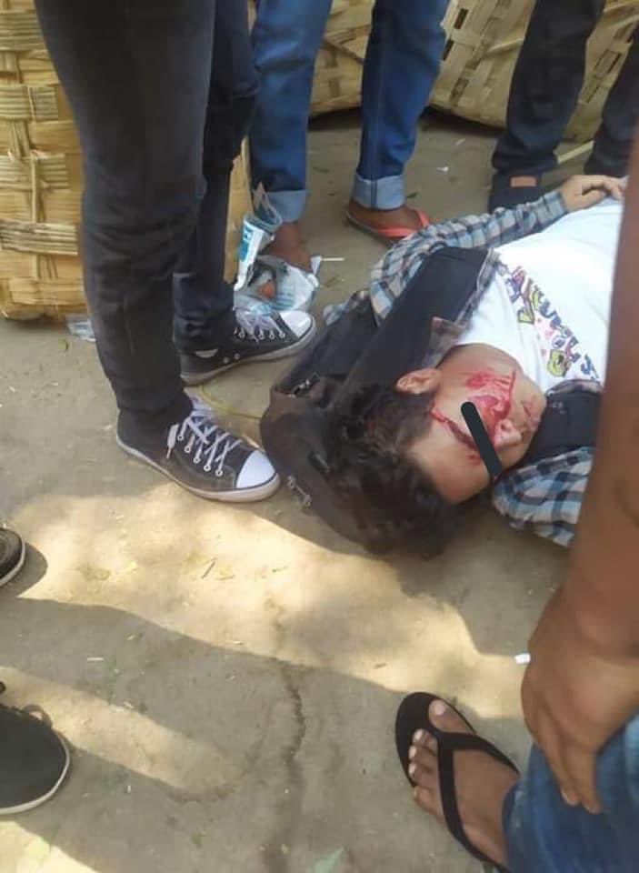 Nov19944's tweet photo. TW// Blood , Gunshot
Myingyan Real bullets and tear gas this morning. Two people have been shot: one in the head and one to the thigh.
JUNTA BESIEGING
#WhatsHappeningInMyanmar  #Mar10Coup https://t.co/TotLPr3KZz