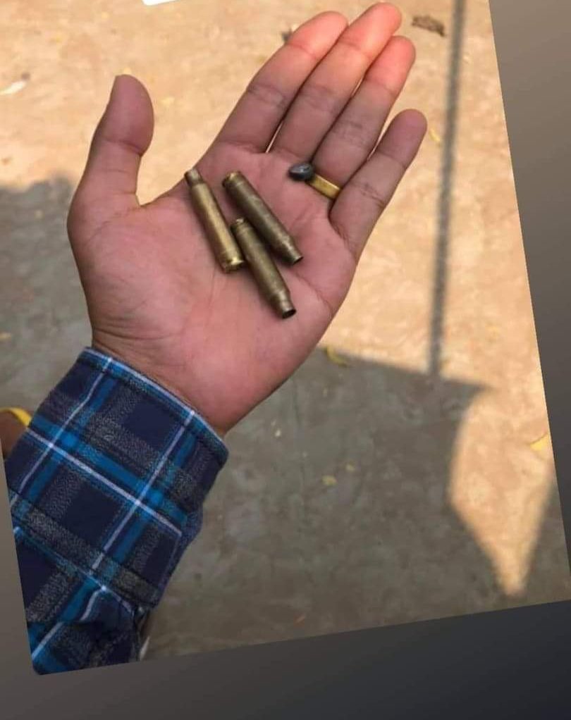 Nov19944's tweet photo. TW// Blood , Gunshot
Myingyan Real bullets and tear gas this morning. Two people have been shot: one in the head and one to the thigh.
JUNTA BESIEGING
#WhatsHappeningInMyanmar  #Mar10Coup https://t.co/TotLPr3KZz
