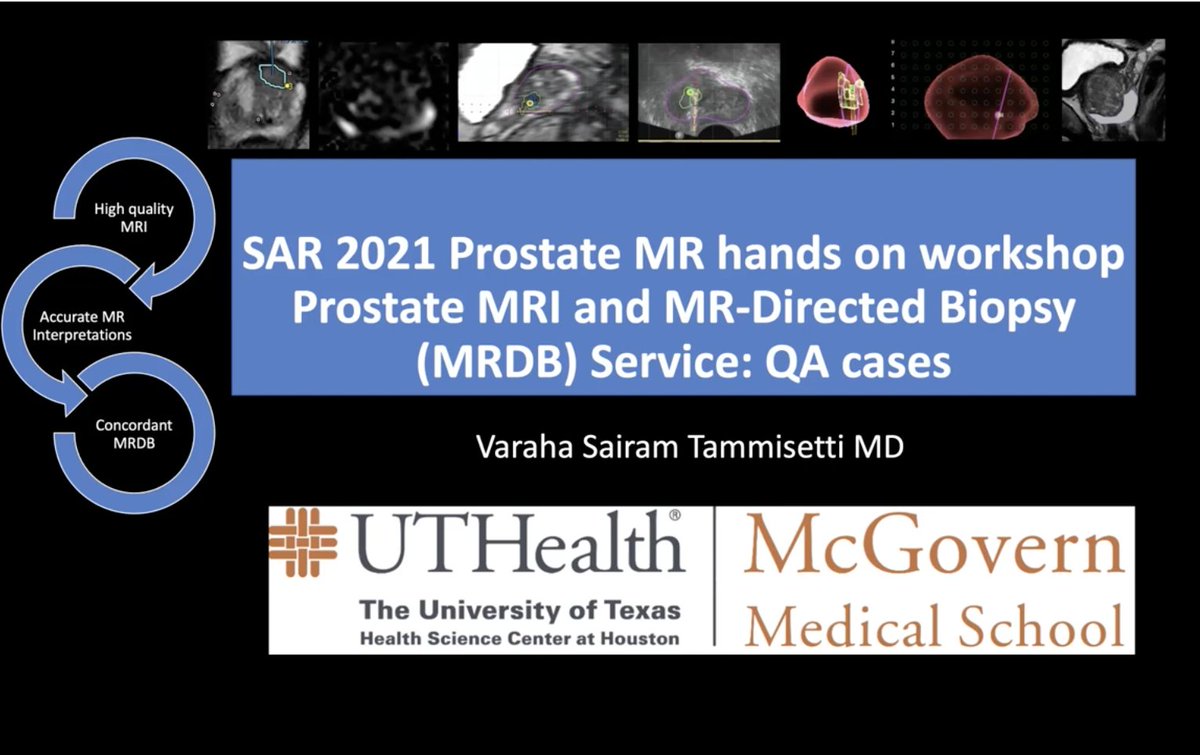 Sandeep Arora (@letddiceflyhigh) on Twitter photo Sneak Peak 2 for Prostate HOC at #SAR2021. Awesome lecture by <a href="/SaiTammi/">Sairam Tammisetti</a> . Video uploaded at <a href="/SAR_ProstateDFP/">SAR Prostate DFP</a> youtube channel -youtu.be/B51SQe84Hmw
Please register rb.gy/wfmb57
@SocAbdRadiology
Please retweet. Sneak Peak 2 for Prostate HOC at #SAR2021. Awesome lecture by <a href="/SaiTammi/">Sairam Tammisetti</a> . Video uploaded at <a href="/SAR_ProstateDFP/">SAR Prostate DFP</a> youtube channel -youtu.be/B51SQe84Hmw
Please register rb.gy/wfmb57
@SocAbdRadiology
Please retweet.