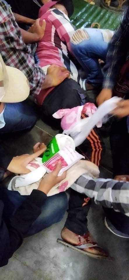 tw // gunshot
Terrorists cracked down peaceful protestors in Myingyan by firing real bullets and tear gas to the crowd. Two people have been shot: one in the head and one to the thigh.
JUNTA BESIEGING

#WhatsHappeningInMyanmar  #Mar10Coup