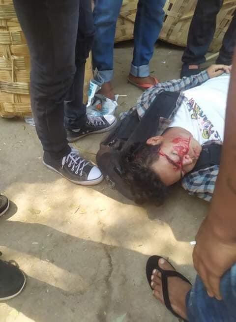 Ye Min Oo (@yeminoox) on Twitter photo 10/3/21 10:20AM Myin-Gyan
tw // blood
Junta's terrorists opened fire and used live ammunition at protesters. 2 got shot at head & leg. Situation still unstable.
<a href="/SiobhanRobbins/">Siobhán Robbins Sky</a> <a href="/TostevinM/">Matthew Tostevin</a> <a href="/USEmbassyBurma/">U.S. Embassy Burma</a> <a href="/DKAmbMyanmar/">Helene Storm</a>
JUNTA BESIEGING
#WhatsHappeningInMyanmar
#Mar10Coup 10/3/21 10:20AM Myin-Gyan
tw // blood
Junta's terrorists opened fire and used live ammunition at protesters. 2 got shot at head & leg. Situation still unstable.
<a href="/SiobhanRobbins/">Siobhán Robbins Sky</a> <a href="/TostevinM/">Matthew Tostevin</a> <a href="/USEmbassyBurma/">U.S. Embassy Burma</a> <a href="/DKAmbMyanmar/">Helene Storm</a>
JUNTA BESIEGING
#WhatsHappeningInMyanmar
#Mar10Coup
