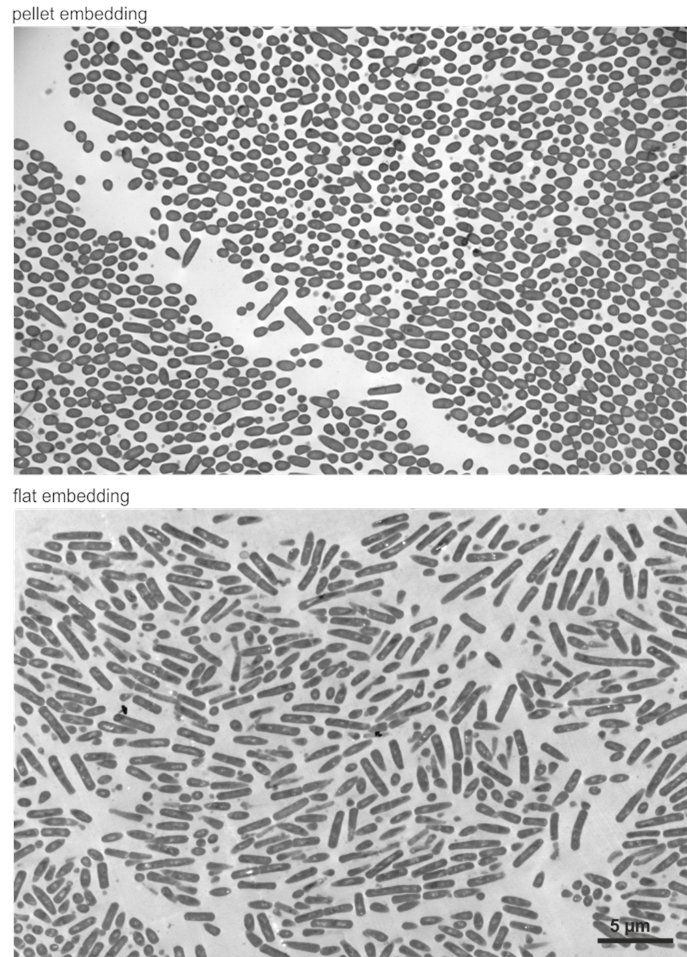 For those of you who would like to cut your cells longitudinal for TEM, our new Comm Biol paper provides a nice method (and also shows why tetracycline induction should be used with care) nature.com/articles/s4200…