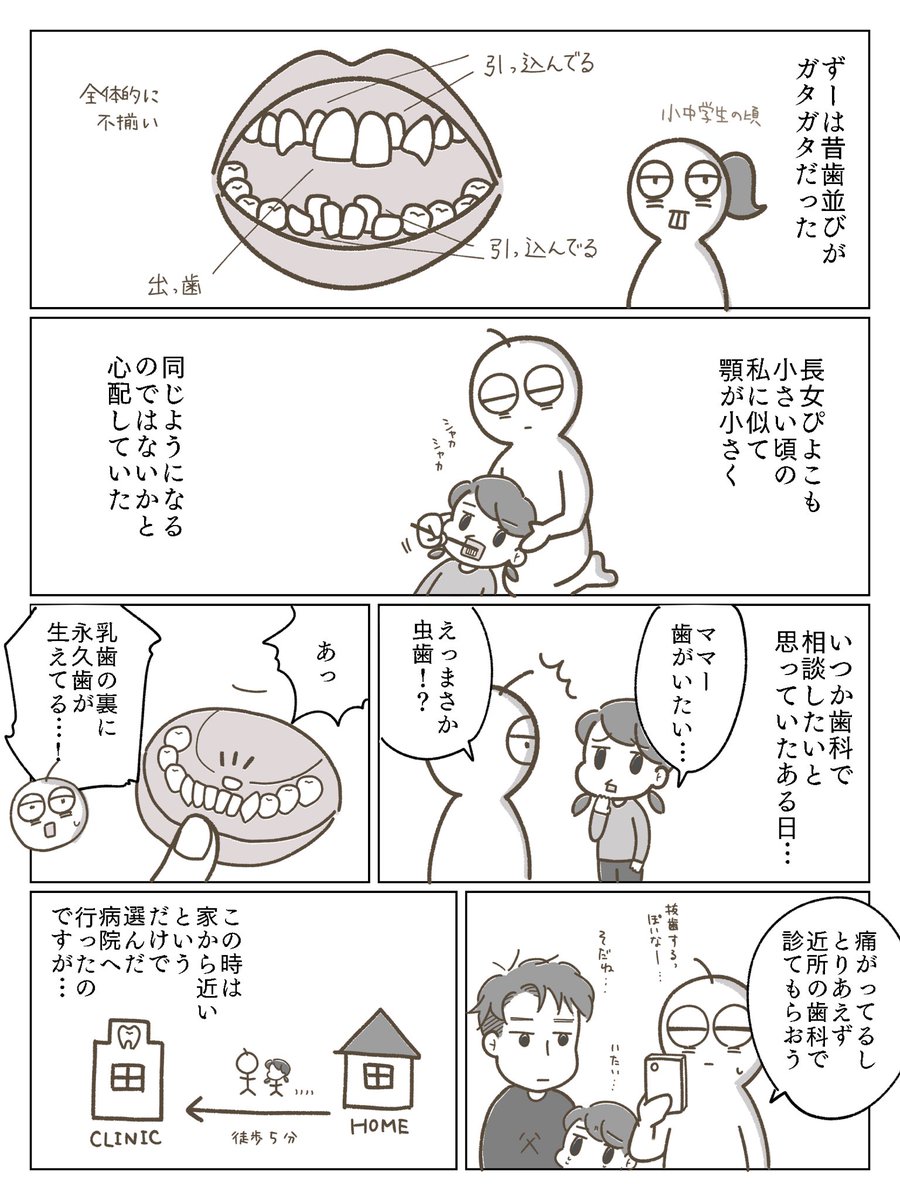 子供の歯科矯正漫画①
まずは矯正に至った経緯をば。

#育児漫画 #育児絵日記 #歯科矯正 #小児歯科矯正 