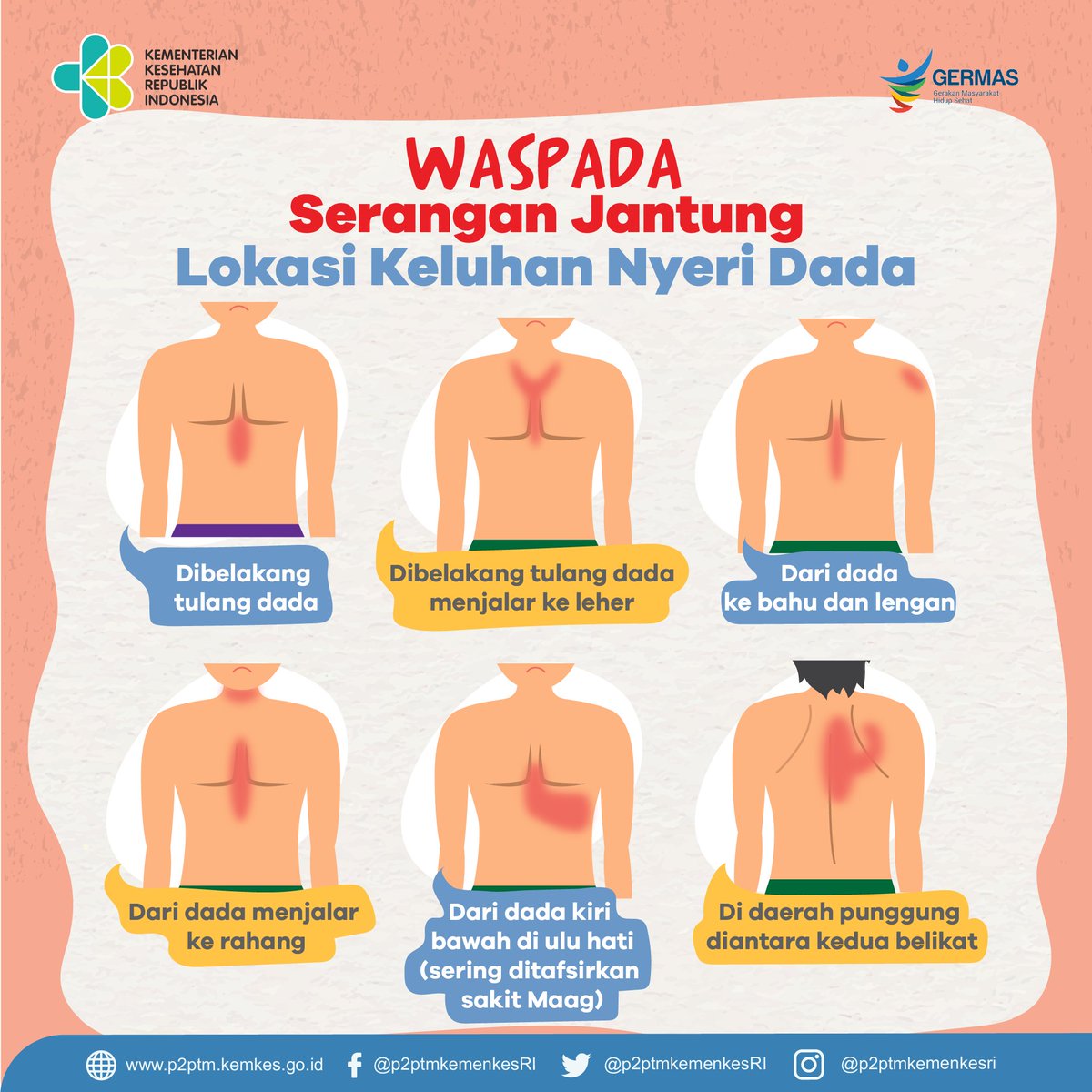 Waspada Serangan Jantung! Inilah Lokasi Keluhan Nyeri Dada
via @p2ptmkemenkesRI