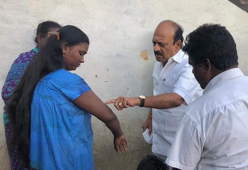 thamoanbarasan's tweet photo. ஆலந்தூர் தொகுதிக்குட்பட்ட, பரணிபுத்தூர்  ஊராட்சி , சின்னபணிச்சேரி கிராம மக்களிடையே பரவிவரும் சருமநோய் பற்றி கேள்விபட்டு 
அப்பகுதிக்கு நேரில் சென்று மக்களை சந்தித்து அது தொடர்பான சிகிச்சைக்காக சுகாதாரத்துறை அதிகாரிகளை உடனடியாக தொடர்புகொண்டு மருத்துவ முகாமினை ஏற்பாடு செய்த போது.. https://t.co/VyrfXxfFDY